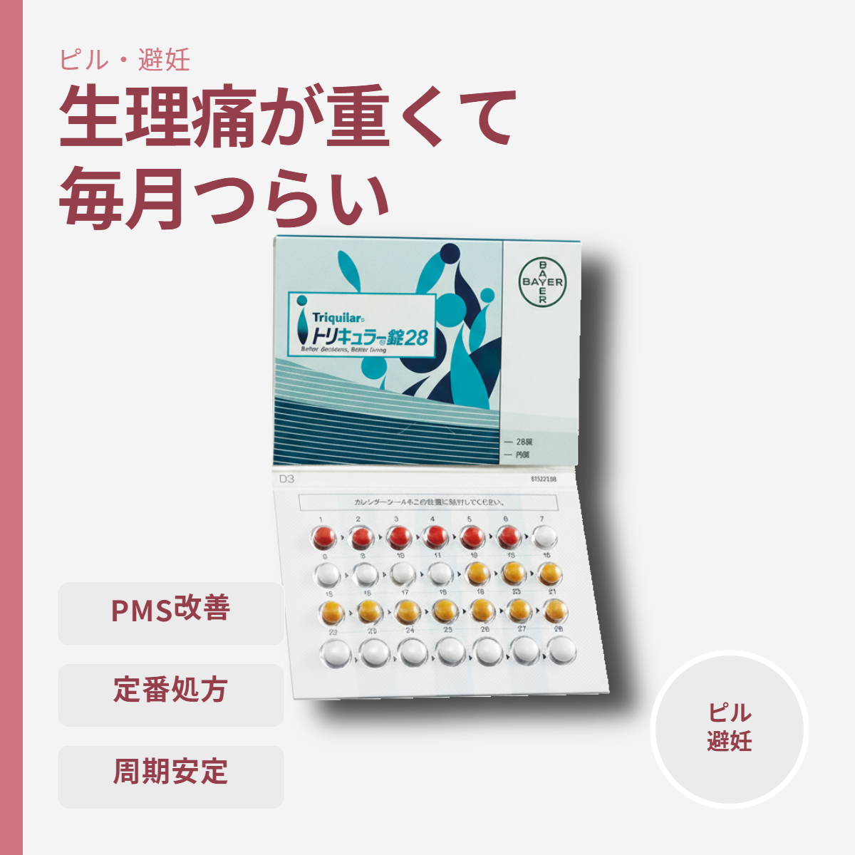 トリキュラー
